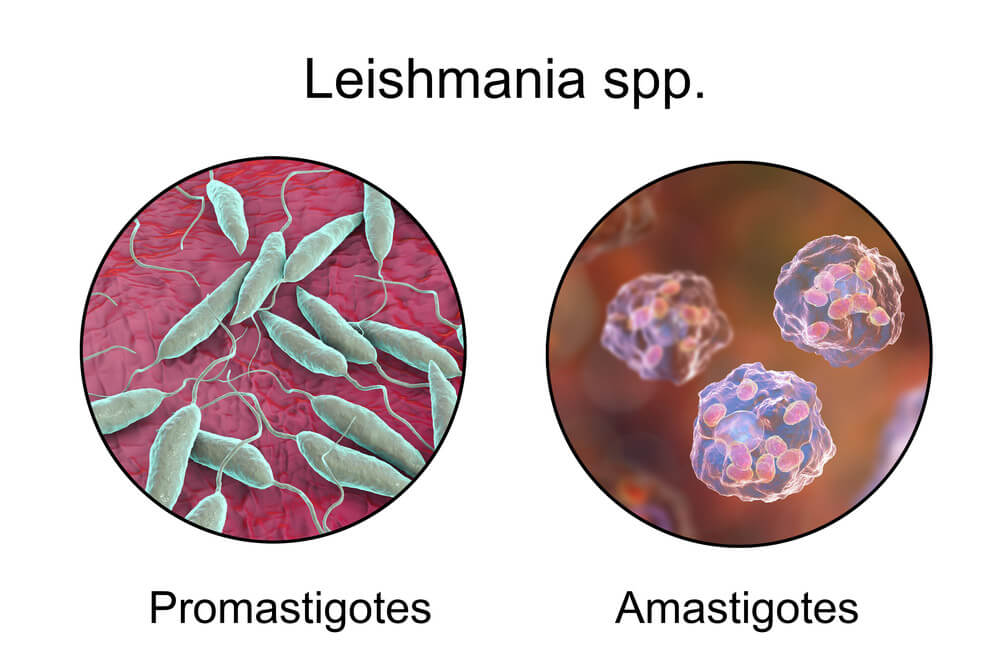 Que es la Leishmaniosis